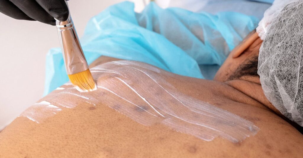 水分不足が大人ニキビを引き起こす仕組みを説明するイラスト