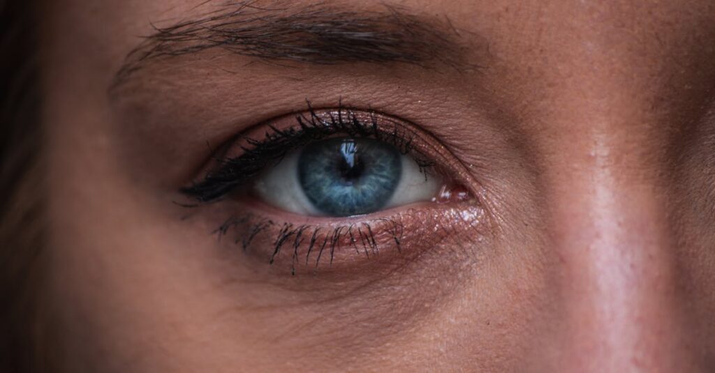 肝斑や炎症後色素沈着など顔のシミの種類を示すイメージ図