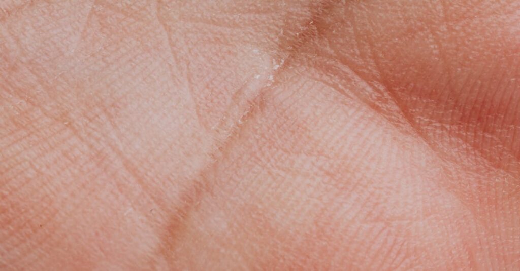 最新の皮膚科学に基づいたニキビケア方法。常在菌・ホルモン・腸内環境に注目した根本的なアプローチ。