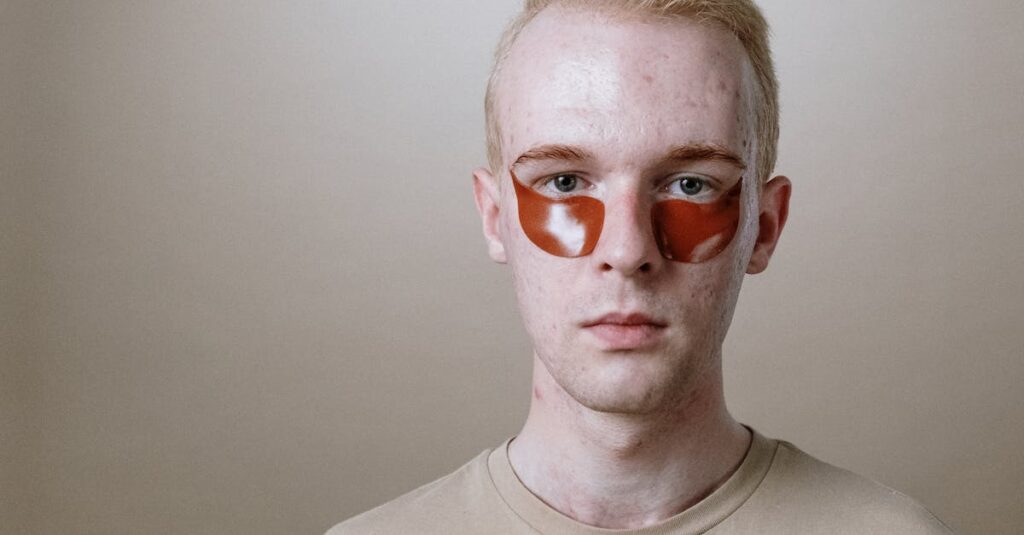 水分不足が大人ニキビを引き起こす仕組みを説明するイラスト