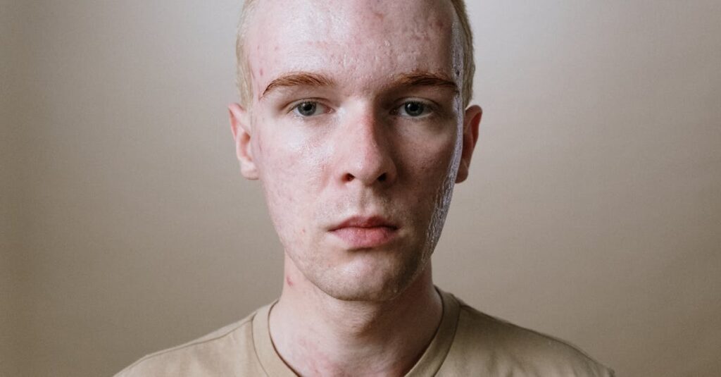 肝臓や腎臓の機能が肌に影響し大人ニキビになることを示す図