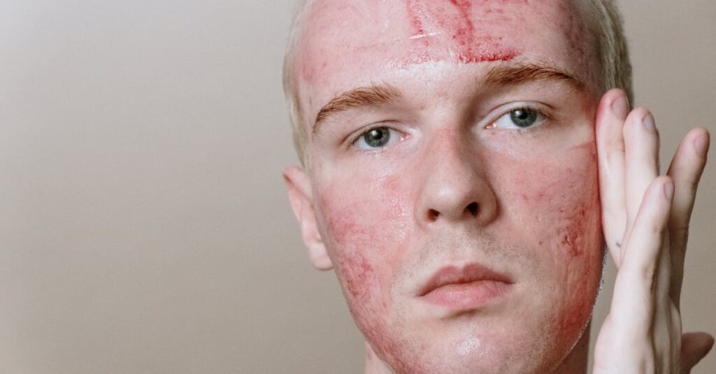 腸内環境と肌トラブルの関係を示す大人ニキビの図解