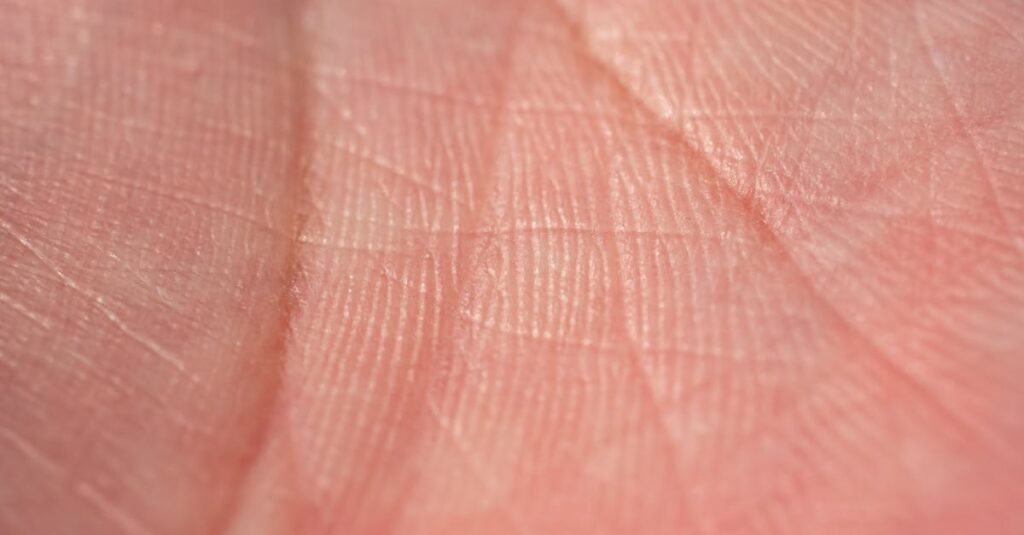 乾燥性皮膚炎とアトピーの違いを比較するチャート形式の図解