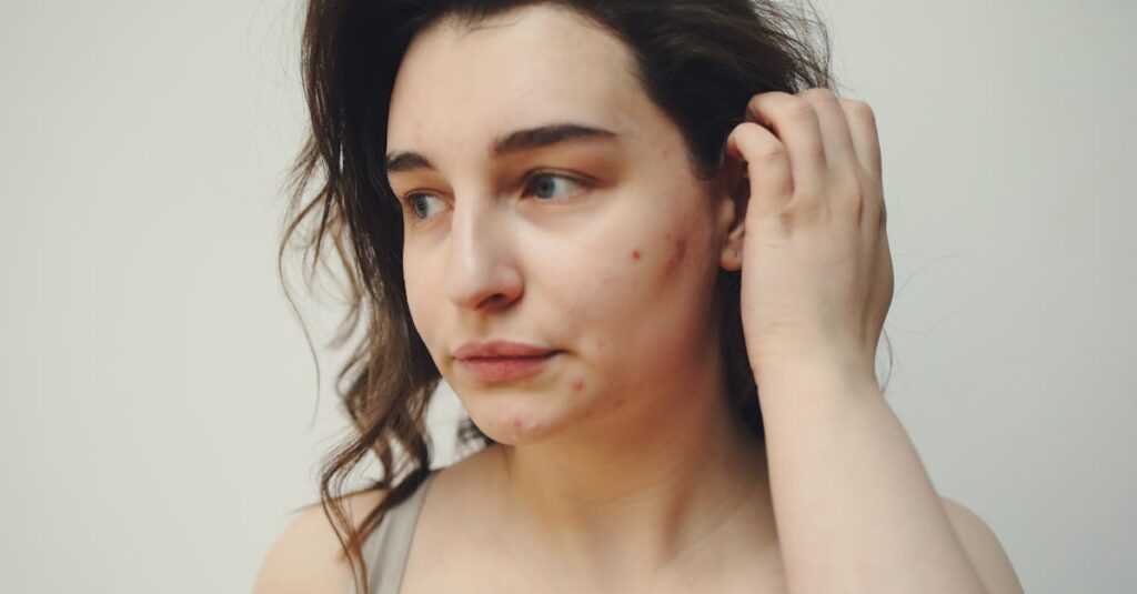 皮膚科の薬だけでは改善しない大人ニキビの図解