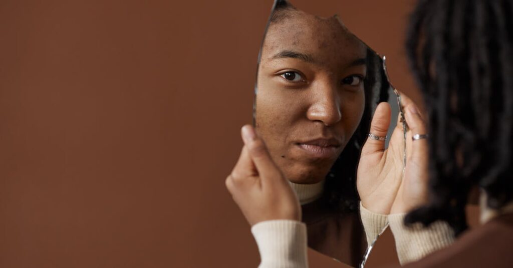 ストレスが原因で大人ニキビが悪化する仕組みを図解で説明したイラスト