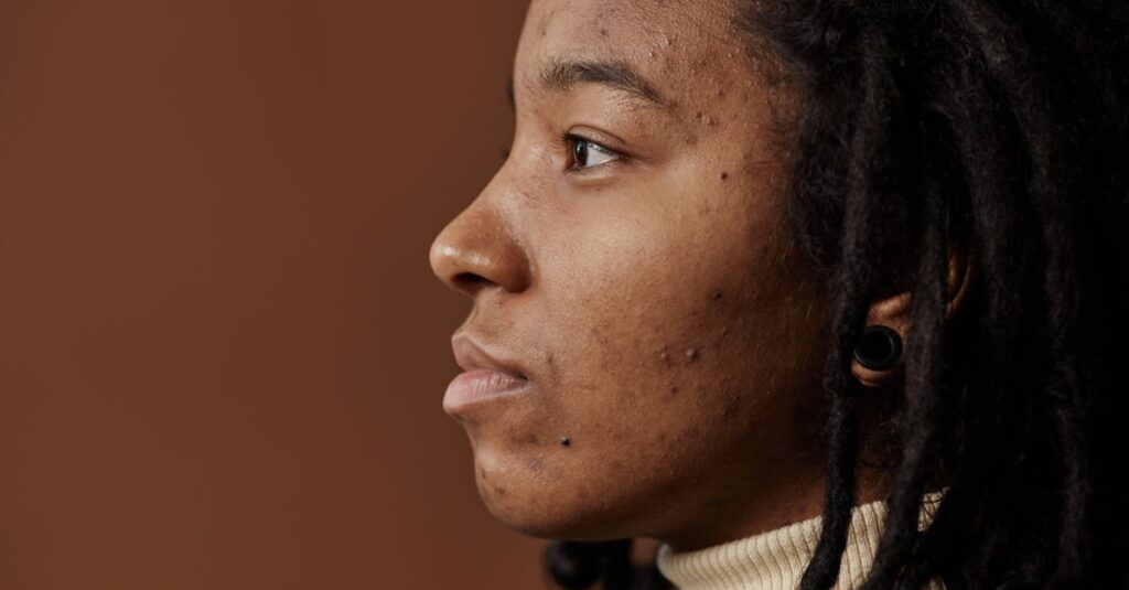 生活習慣の見直しで内側から大人ニキビを改善する習慣の図解