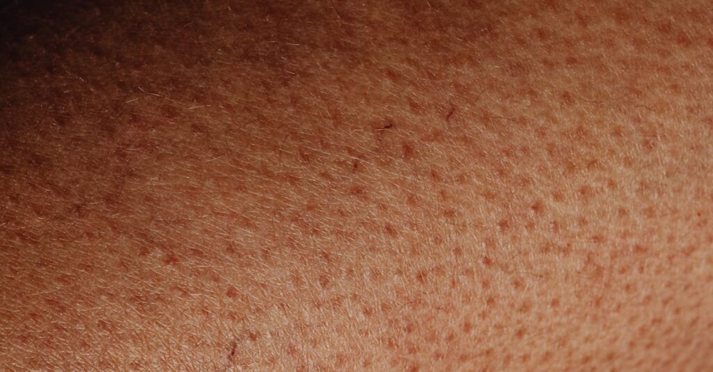 肝斑や炎症後色素沈着など顔のシミの種類を示すイメージ図