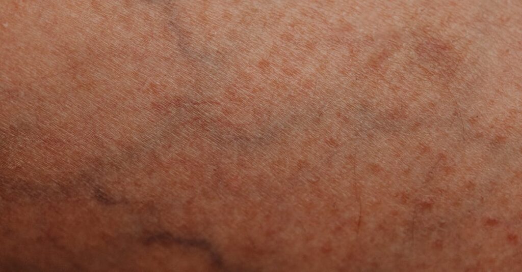 体内脱水や腸内環境の悪化が乾燥肌に影響している仕組みの図解