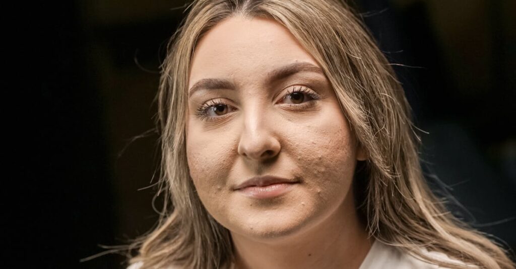 肝臓や腎臓の機能が肌に影響し大人ニキビになることを示す図