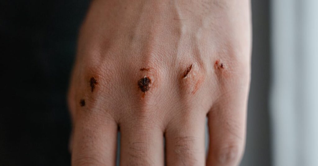 摩擦による肌バリアの破壊と乾燥悪化のメカニズムが図で示されている