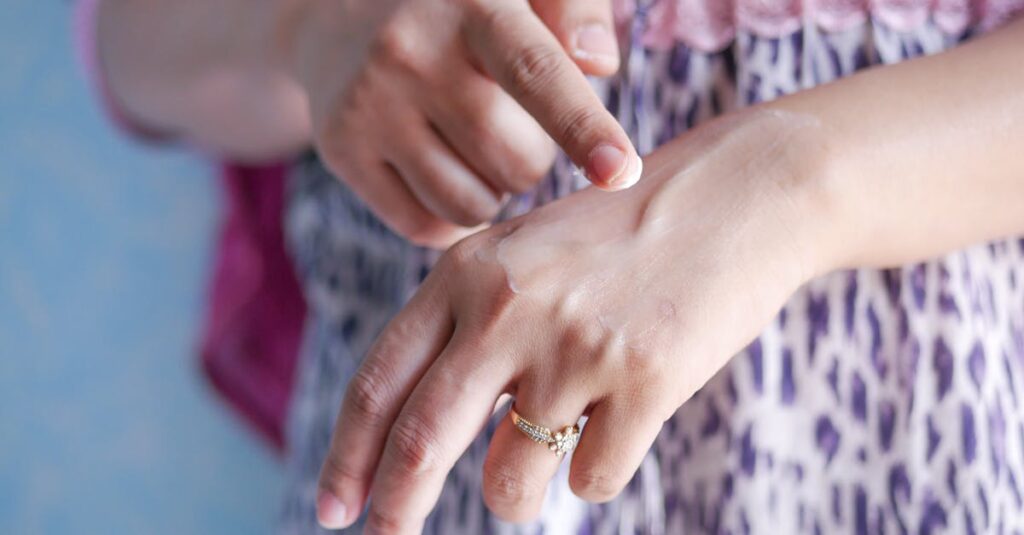 保湿のしすぎによる肌バリア機能の低下