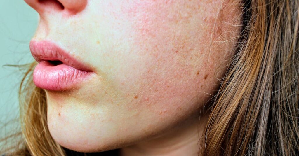 肌のトーンが明るくなった女性の笑顔の横顔