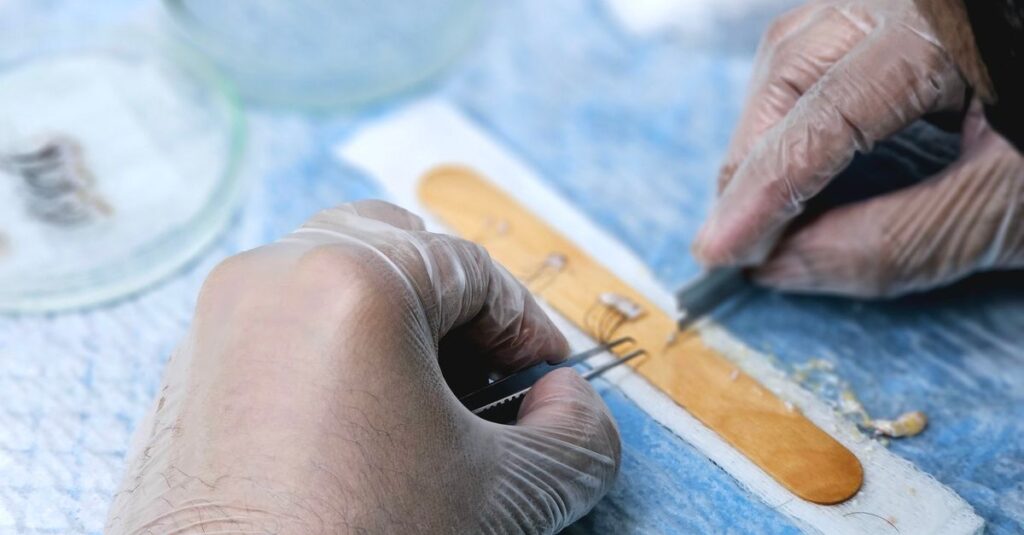 脂肪の生着率を高めるための高度な注入技術と品質管理がTHE CLINICの強み