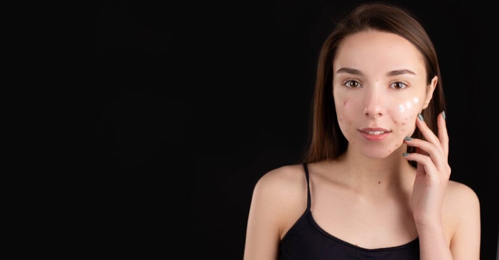 ファンケルのアクネケアジェル乳液（医薬部外品）の使用イメージ